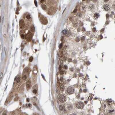 Immunohistochemistry-Paraffin: PECR Antibody [NBP1-83198]