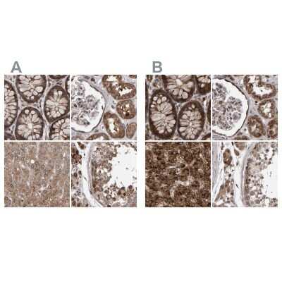 Immunohistochemistry-Paraffin: PECR Antibody [NBP1-83199]