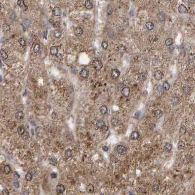 Immunohistochemistry-Paraffin: PECR Antibody [NBP1-83199]