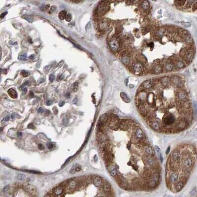 Immunohistochemistry-Paraffin: PECR Antibody [NBP1-83199]