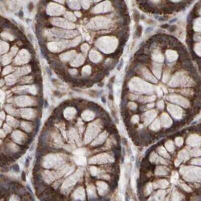 Immunohistochemistry-Paraffin: PECR Antibody [NBP1-83199]