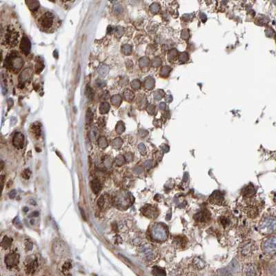 Immunohistochemistry-Paraffin: PECR Antibody [NBP1-83199]