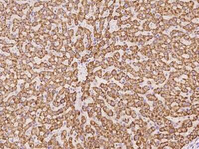 Immunohistochemistry-Paraffin: PECR Antibody [NBP2-97903]