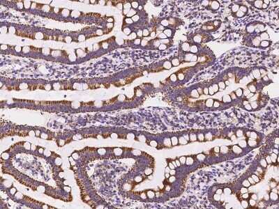 Immunohistochemistry-Paraffin: PECR Antibody [NBP2-97903]