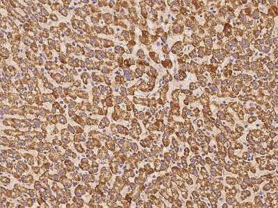 Immunohistochemistry-Paraffin: PECR Antibody [NBP2-97904]