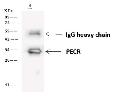 Immunoprecipitation: PECR Antibody [NBP2-97904]