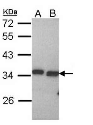 Western Blot: PECR Antibody [NBP1-31699]