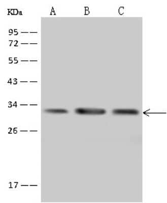 Western Blot: PECR Antibody [NBP2-97904]