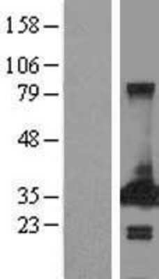 Western Blot: PECR Overexpression Lysate [NBL1-14277]