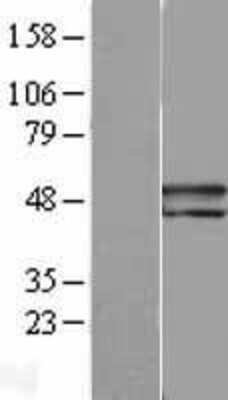 Western Blot: Serpin F1/PEDF Overexpression Lysate [NBL1-15854]