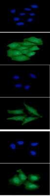 Immunocytochemistry/ Immunofluorescence: PEDFR/PNPLA2/ATGL Antibody (AT18E6) - BSA Free [NBP2-59390]