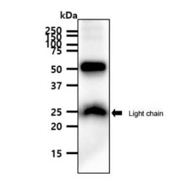 Western Blot: PEDFR/PNPLA2/ATGL Antibody (AT18E6)BSA Free [NBP2-59390]