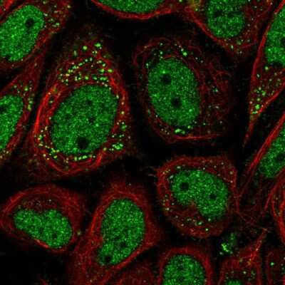 Immunocytochemistry/ Immunofluorescence: PEDFR/PNPLA2/ATGL Antibody [NBP2-57480]