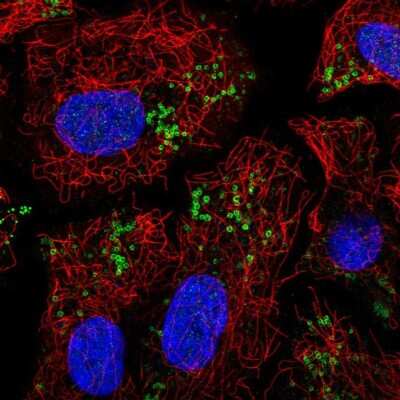 Immunocytochemistry/ Immunofluorescence: PEDFR/PNPLA2/ATGL Antibody [NBP2-58046]