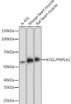 Western Blot: PEDFR/PNPLA2/ATGL Antibody (10Y4M10) [NBP3-16567]