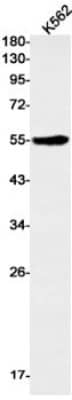 Western Blot: PEDFR/PNPLA2/ATGL Antibody (S08-3F5) [NBP3-19942]