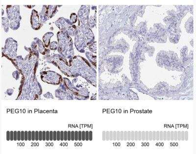 Immunohistochemistry-Paraffin: PEG10 Antibody [NBP2-13749]