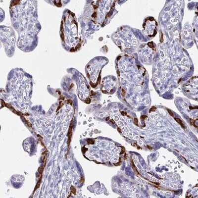 Immunohistochemistry-Paraffin: PEG10 Antibody [NBP2-13749]