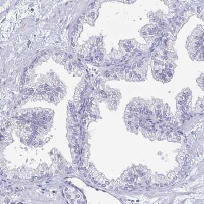 Immunohistochemistry-Paraffin: PEG10 Antibody [NBP2-13749]