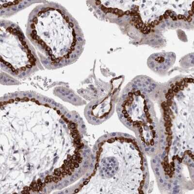 Immunohistochemistry-Paraffin: PEG10 Antibody [NBP2-48592]