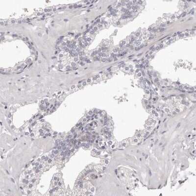 Immunohistochemistry-Paraffin: PEG10 Antibody [NBP2-48592]