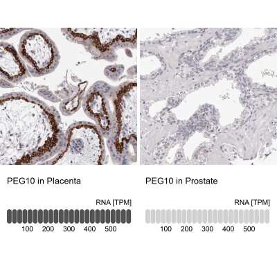 Immunohistochemistry-Paraffin: PEG10 Antibody [NBP2-48592]