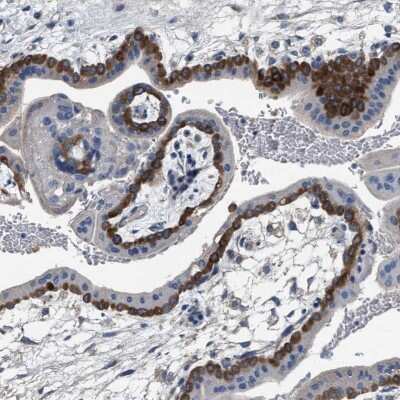Immunohistochemistry-Paraffin: PEG10 Antibody [NBP2-54675]