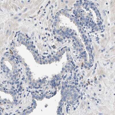 Immunohistochemistry-Paraffin: PEG10 Antibody [NBP2-54675]