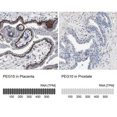 Immunohistochemistry-Paraffin: PEG10 Antibody [NBP2-54675]