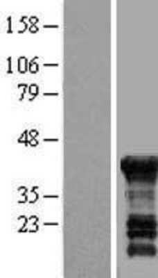 Western Blot: PEG10 Overexpression Lysate [NBL1-14280]