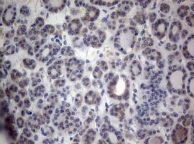 Immunohistochemistry: PEG3 Antibody (OTI1E10) [NBP2-46379]