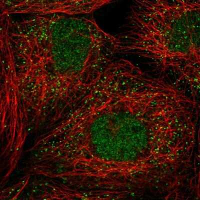 Immunocytochemistry/ Immunofluorescence: PELI3 Antibody [NBP2-37988]