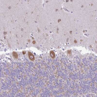 Immunohistochemistry-Paraffin: PELI3 Antibody [NBP2-37889]