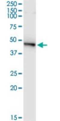 Immunoprecipitation: PELO Antibody (2C2) [H00053918-M03]