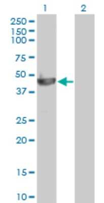 Western Blot: PELO Antibody (2C2) [H00053918-M03]