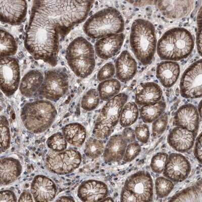 Immunohistochemistry-Paraffin: PELO Antibody [NBP1-85923]