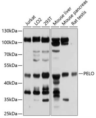 Western Blot: PELO AntibodyAzide and BSA Free [NBP2-93279]