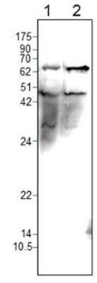 Western Blot: PELO Antibody [NBP3-12192]