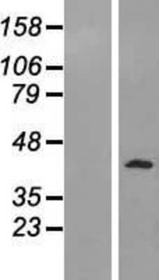 Western Blot: PELO Overexpression Lysate [NBL1-14284]