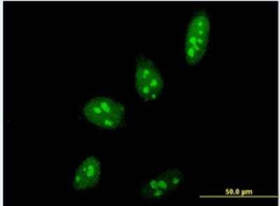 Immunocytochemistry/ Immunofluorescence: PELP1 Antibody (4F3) [H00027043-M06-100ug]