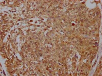 Immunohistochemistry: PELP1 Antibody (6H4) [NBP3-15157]