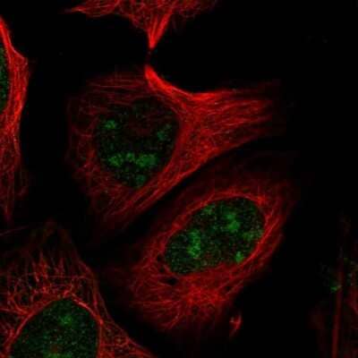 Immunocytochemistry/ Immunofluorescence: PELP1 Antibody [NBP2-56265]