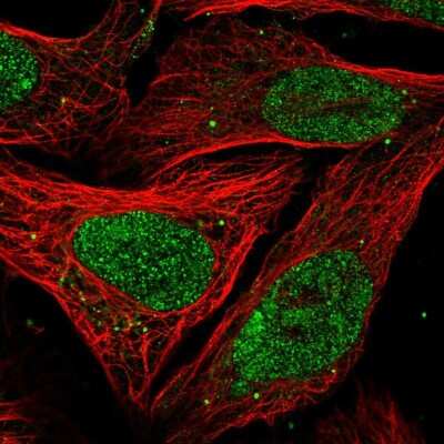 Immunocytochemistry/ Immunofluorescence: PELP1 Antibody [NBP2-58736]