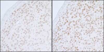 Immunohistochemistry-Paraffin: PELP1 Antibody [NB200-331]
