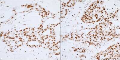 Immunohistochemistry-Paraffin: PELP1 Antibody [NB200-331]