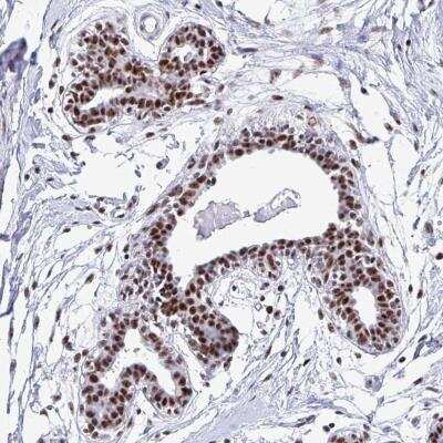 Immunohistochemistry-Paraffin: PELP1 Antibody [NBP2-32565]