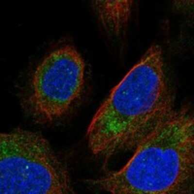 Immunocytochemistry/ Immunofluorescence: PEMT Antibody [NBP3-17907]