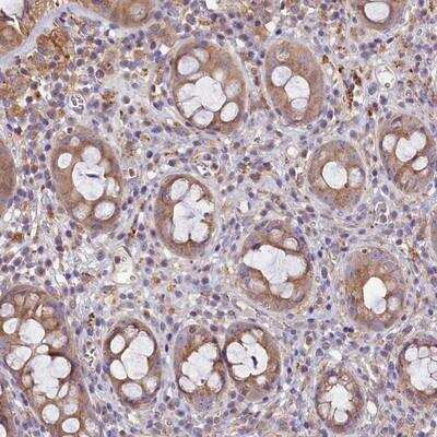 Immunohistochemistry: PEMT Antibody [NBP1-87297]