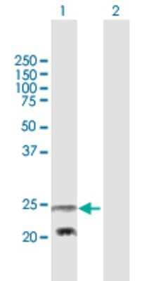 Western Blot: PEMT Antibody [H00010400-B01P]