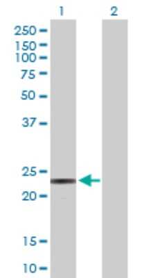 Western Blot: PEMT Antibody [H00010400-D01P]